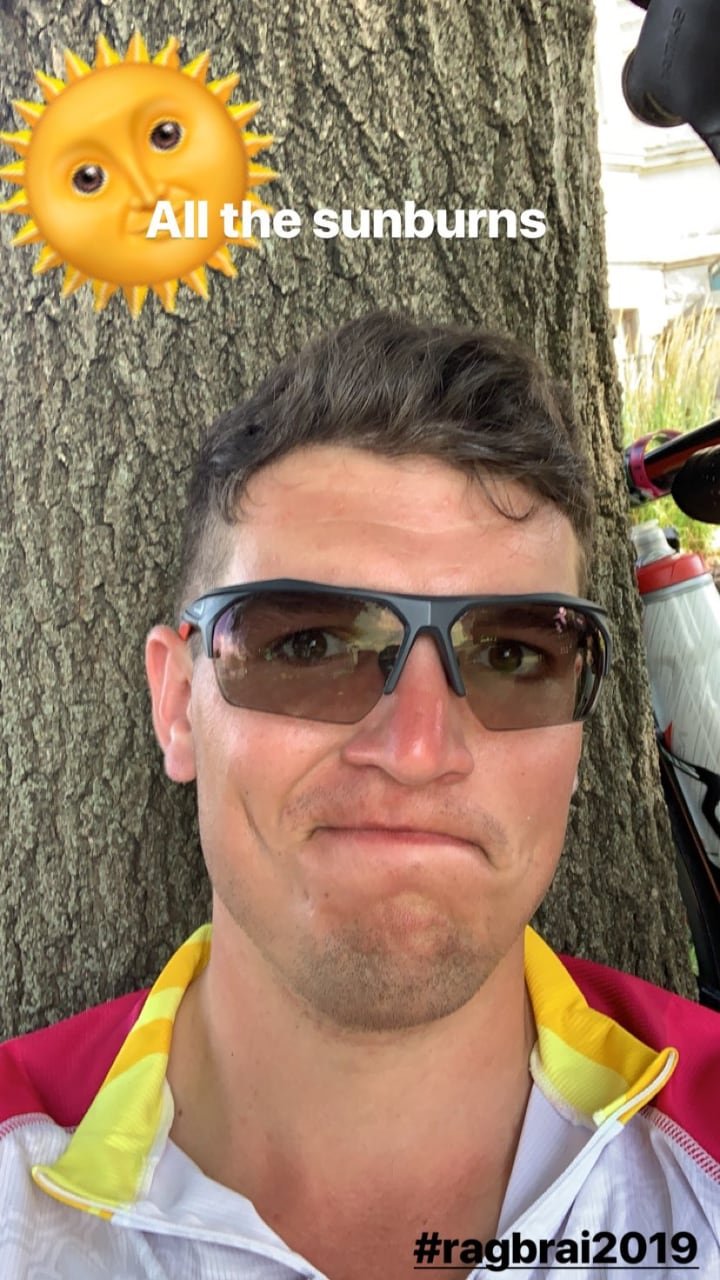 My face, very sunburnt